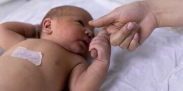 Teste do olhinho deve ser repetido três vezes ao ano até os 3 anos