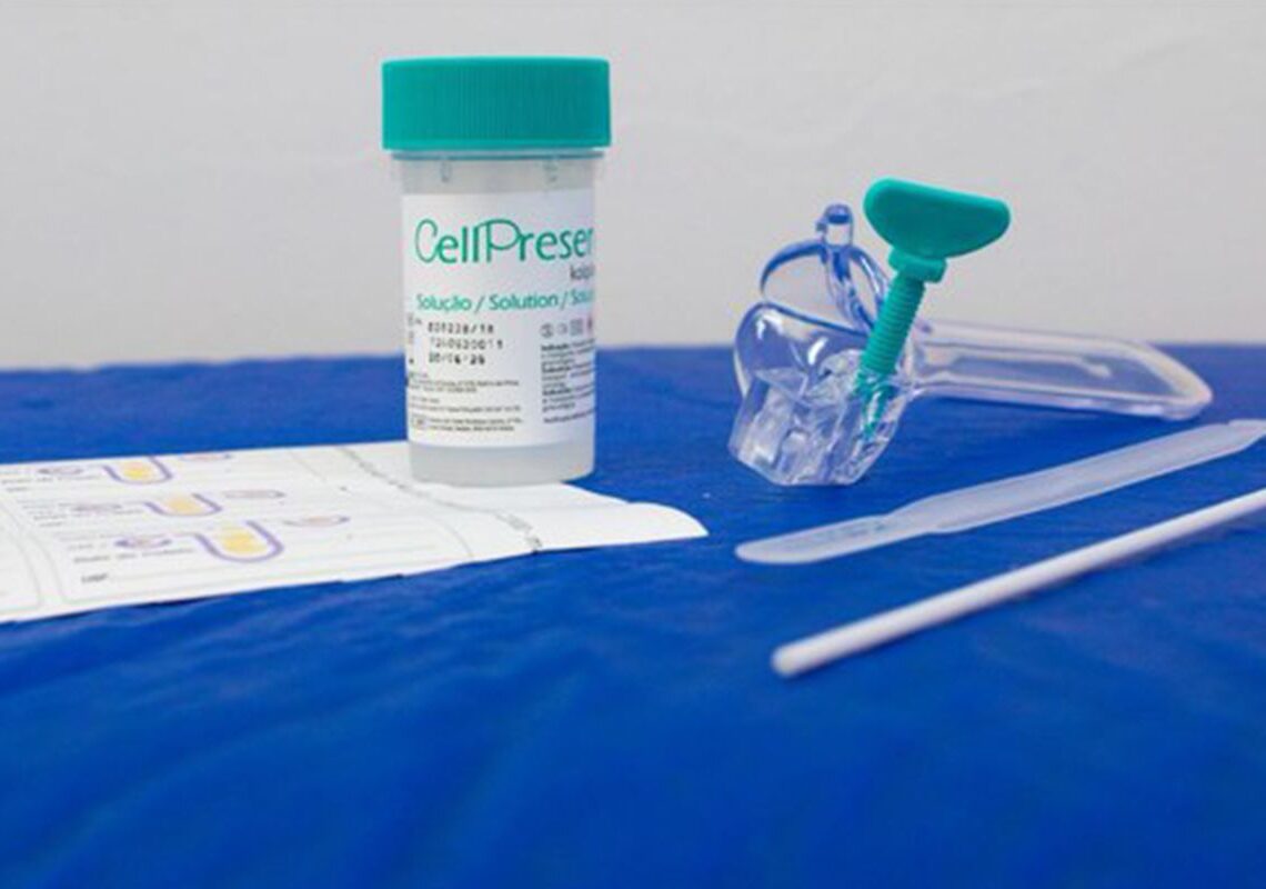 Saiba como é o novo teste do SUS para detectar câncer do colo do útero