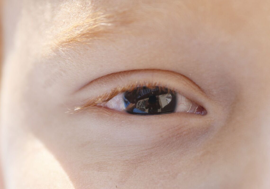 Erros de refração são principal causa de deficiência visual infantil