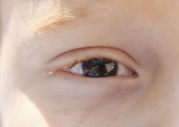 Erros de refração são principal causa de deficiência visual infantil