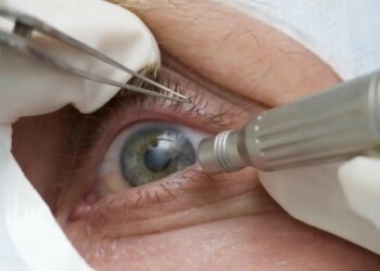 Falta de consultas regulares aumenta chance de doenças graves na visão