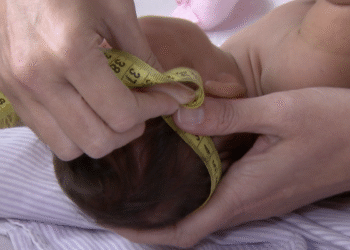 Governo regulamenta indenização e pensão a vítimas do vírus Zika