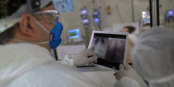 Covid é principal causa de internação por síndrome respiratória no Rio