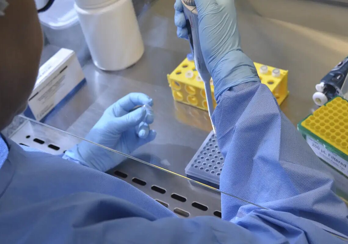 País tem 17 casos confirmados de intoxicação por metanol