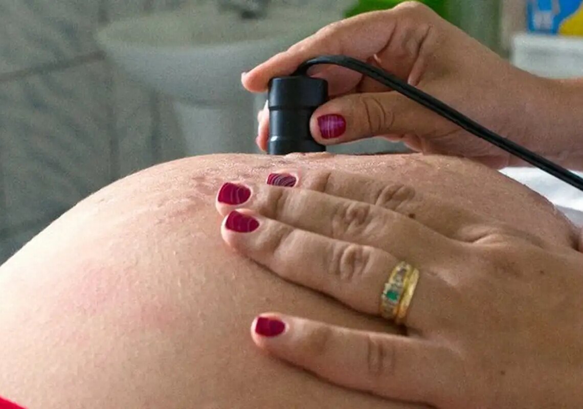 Gravidez na adolescência deve ser debatida nas igrejas, diz ministro