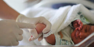 25 de setembro será Dia Nacional de Prevenção da Asfixia Perinatal — Senado Notícias