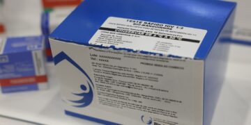 Fiocruz vai ampliar produção de kits diagnósticos para o SUS