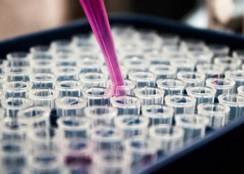 Estudo mostra que inflamação no cérebro pode ser chave do Alzheimer