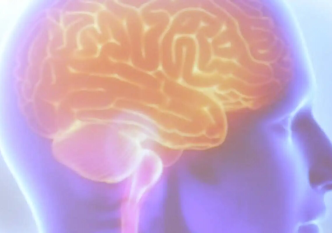 Projeto Ártemis avalia genética de pacientes que sofreram AVC