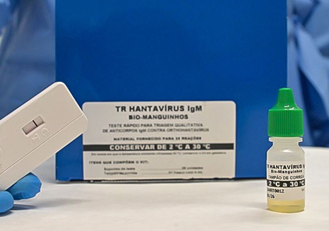 Novo teste faz diagnóstico de hantavirose em 20 minutos