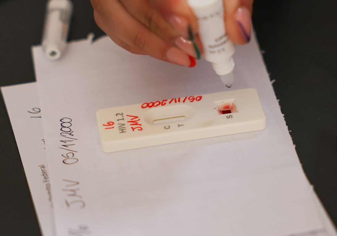 Ação no DF oferece testagem rápida e informação sobre HIV/Aids