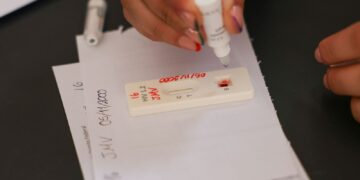 Ação no DF oferece testagem rápida e informação sobre HIV/Aids