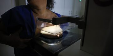 Vigitel: 92% das brasileiras entre 50 e 69 anos fizeram mamografia