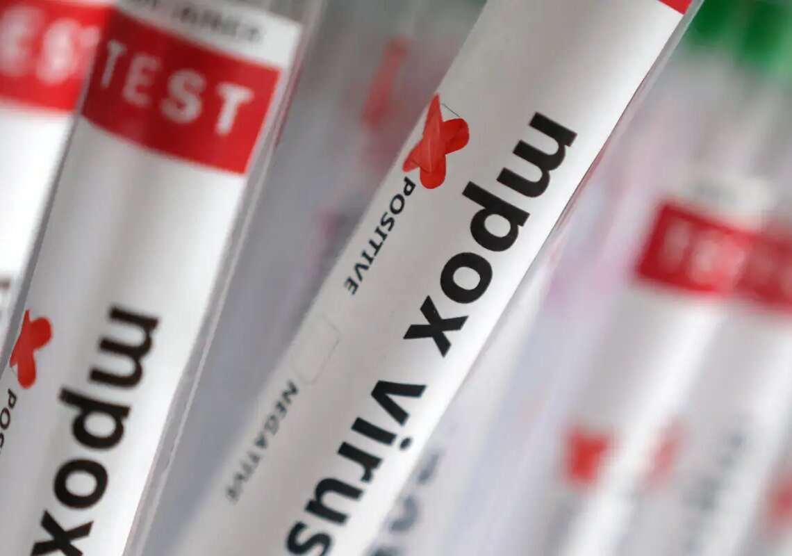 Sobe para 140 número de casos confirmados de Mpox no país, em 2026