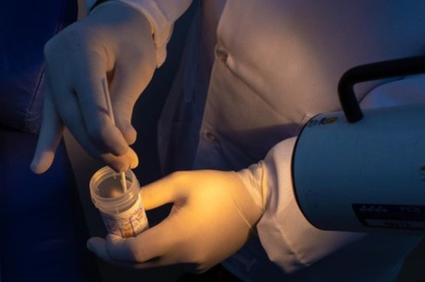 Projeto busca ampliar rastreamento do câncer do colo do útero no SUS — Senado Notícias