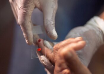 SUS começa a usar novo tratamento contra a malária em crianças