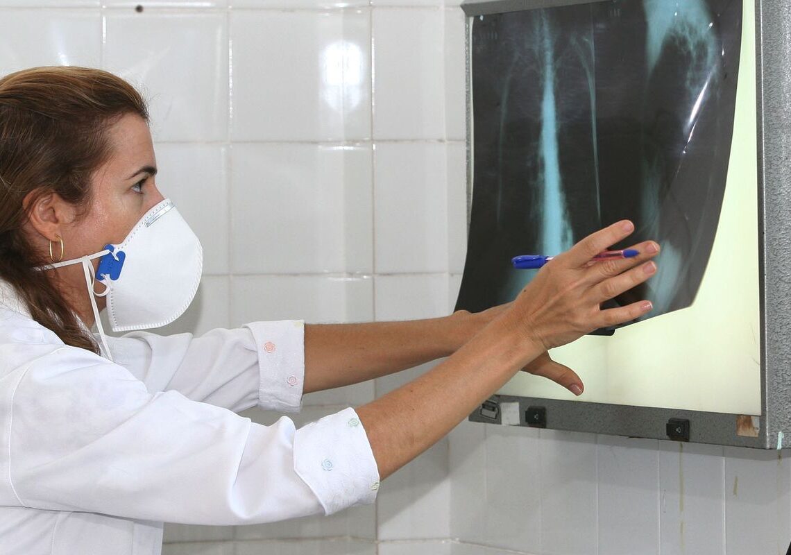 OMS recomenda testes de diagnóstico rápido para erradicar tuberculose