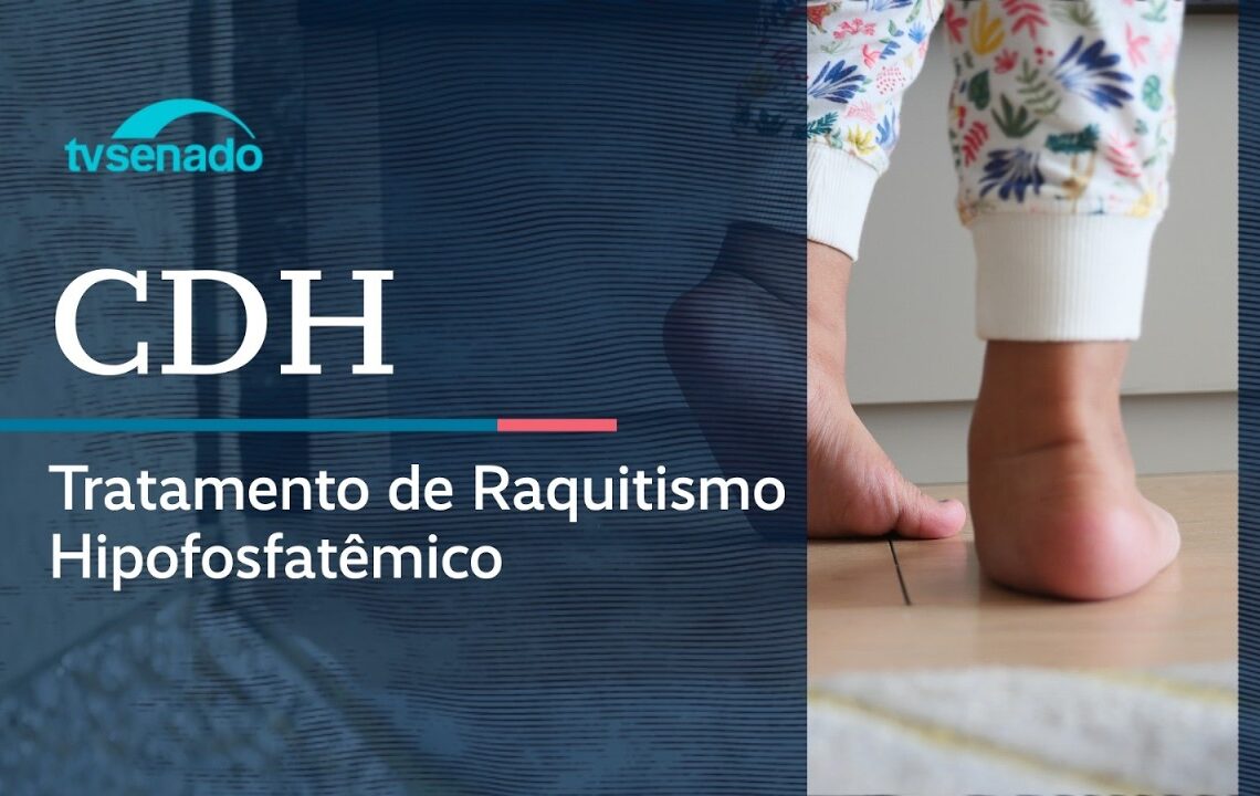 Vídeo: Ao vivo: CDH debate tratamento do raquitismo no SUS – 23/4/26