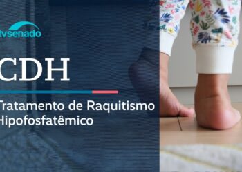 Vídeo: Ao vivo: CDH debate tratamento do raquitismo no SUS – 23/4/26