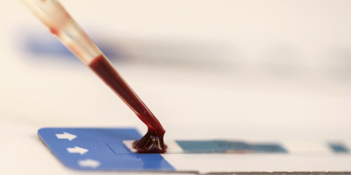 Estudo inédito da Fiocruz pode ampliar prevenção de HIV entre jovens