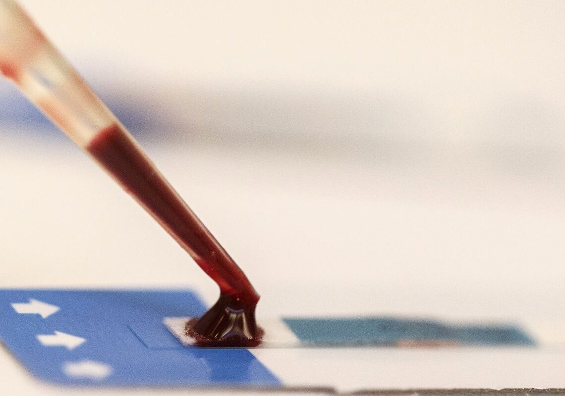 Estudo inédito da Fiocruz pode ampliar prevenção de HIV entre jovens