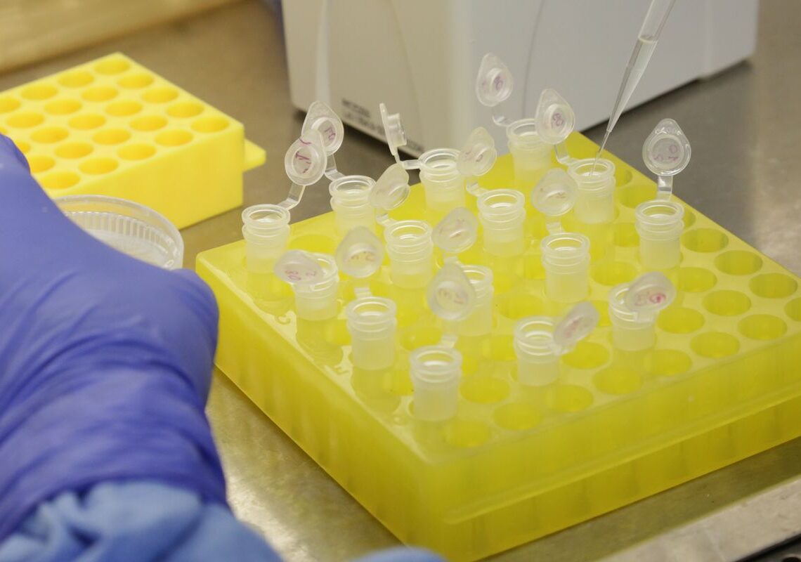 SP confirma segundo caso importado de sarampo