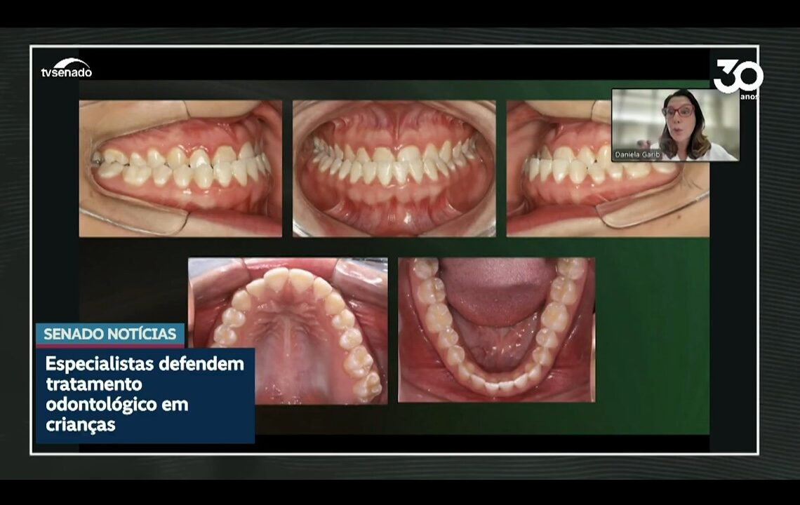 Dentistas defendem tratamento de problemas ortodônticos na infância — Senado Notícias