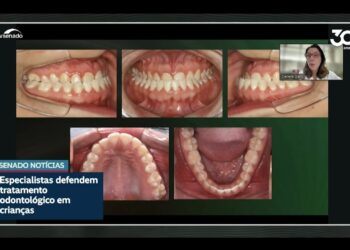 Dentistas defendem tratamento de problemas ortodônticos na infância — Senado Notícias