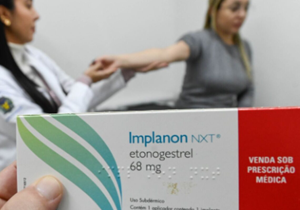 SUS qualifica profissionais para ampliar oferta de implantes hormonais