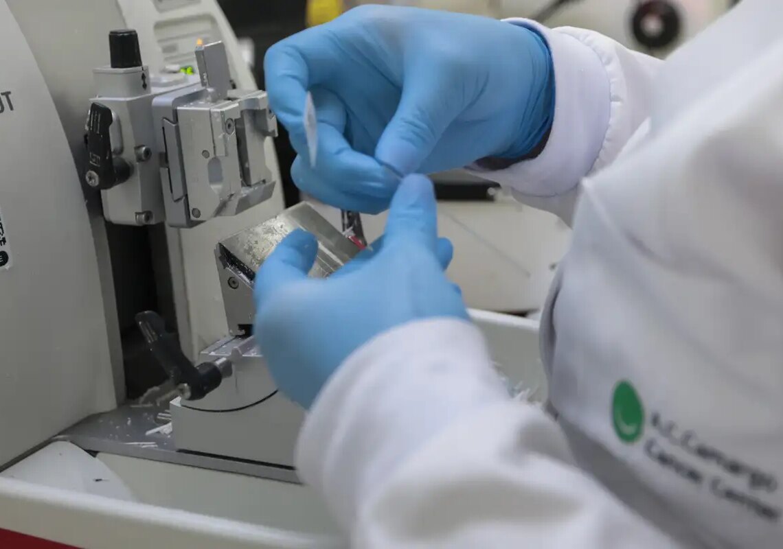 Publicada lei que amplia prevenção e controle do câncer no SUS