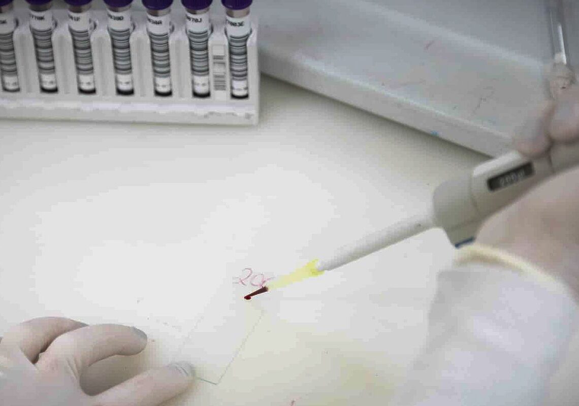 Paciente em SP com suspeita de ebola testa positivo para meningite