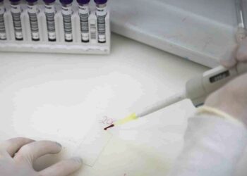 Paciente em SP com suspeita de ebola testa positivo para meningite
