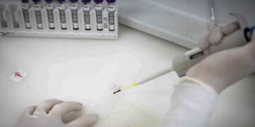 Paciente em SP com suspeita de ebola testa positivo para meningite