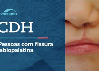 Vídeo: Ao vivo: CDH discute atenção integral para  fissura labiopalatina – 22/6/26