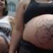 Fatores sociais e estruturais empurram mulheres para cesarianas