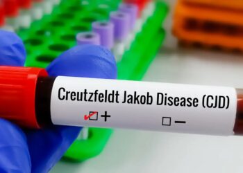 Entenda Doença de Creutzfeldt-Jakob e busca por tratamento
