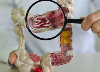 Em 13 anos, doença inflamatória intestinal cresce 5 vezes no Brasil