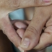 Dermatite atópica impacta pele, sono e autoestima: saiba como tratar