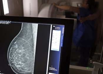 Entidades alertam médicos sobre pedidos de mamografia digital