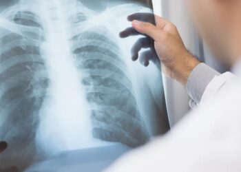 Anvisa aprova novo medicamento para câncer de pulmão avançado