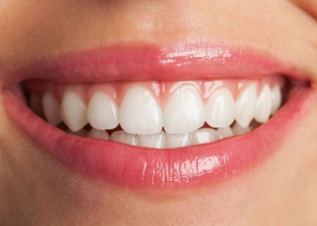 Sorriso de filtro: os perigos das receitas caseiras e dos clareadores de internet 